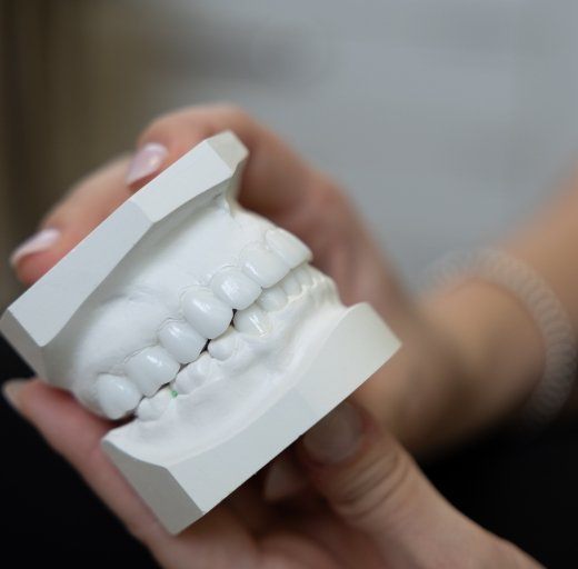Model smile demonstrating effects of porcelain veneers